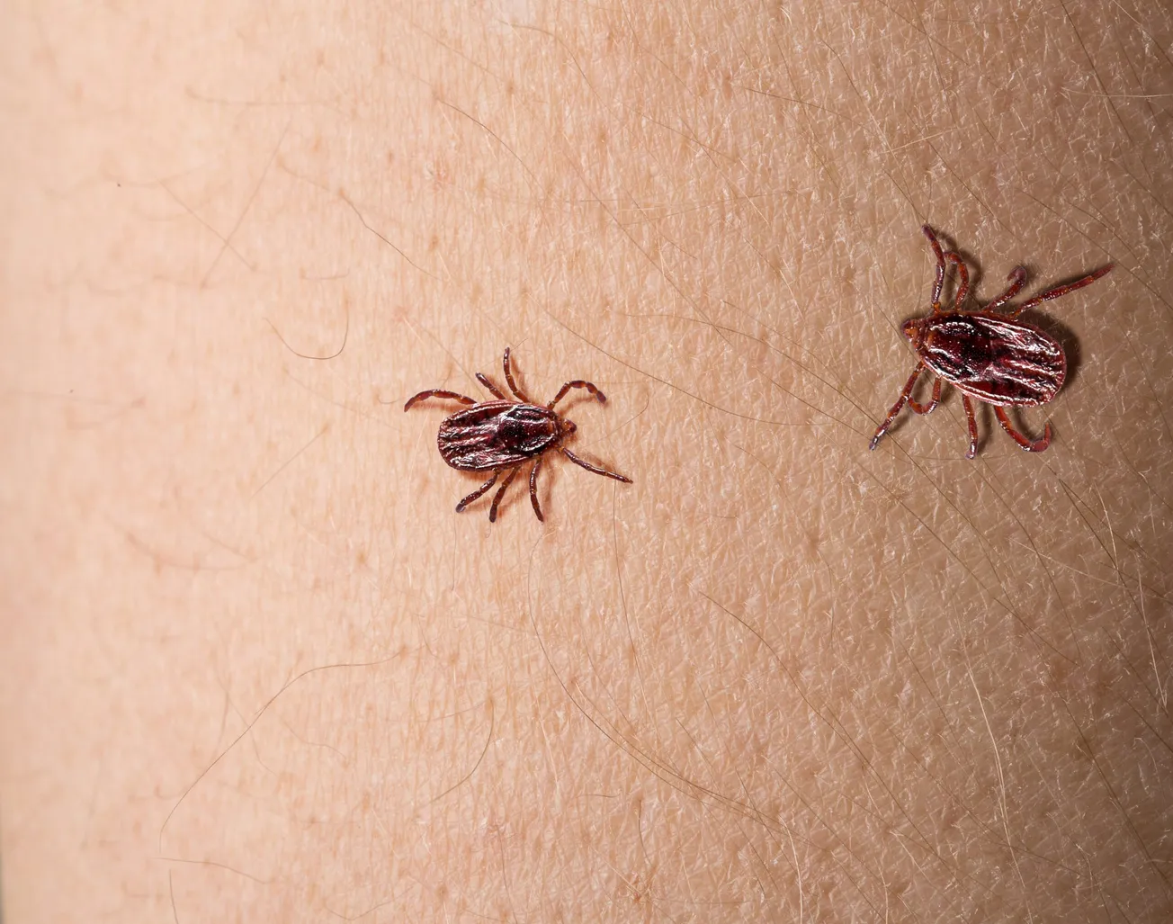 It's tick season: here's how to prepare